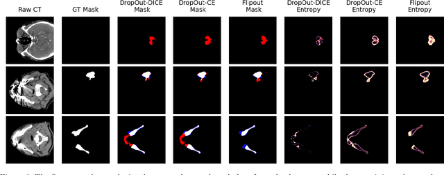 Figure 3 for Comparing Bayesian Models for Organ Contouring in Headand Neck Radiotherapy