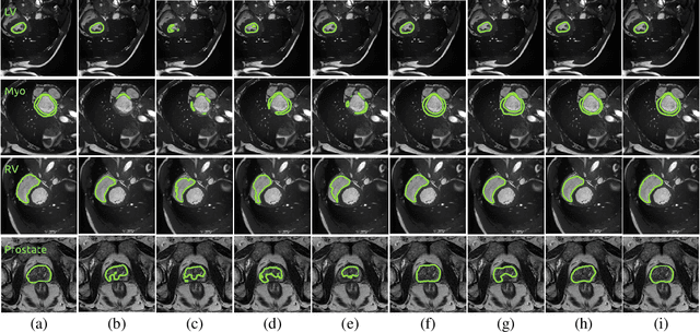 Figure 3 for Context-aware virtual adversarial training for anatomically-plausible segmentation