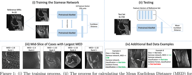 Figure 1 for Semi-Supervised Siamese Network for Identifying Bad Data in Medical Imaging Datasets