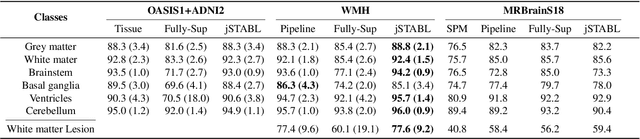 Figure 4 for Learning joint segmentation of tissues and brain lesions from task-specific hetero-modal domain-shifted datasets