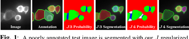 Figure 1 for J Regularization Improves Imbalanced Multiclass Segmentation