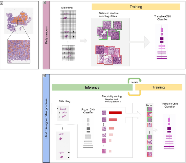 Figure 2 for A deep learning model for gastric diffuse-type adenocarcinoma classification in whole slide images