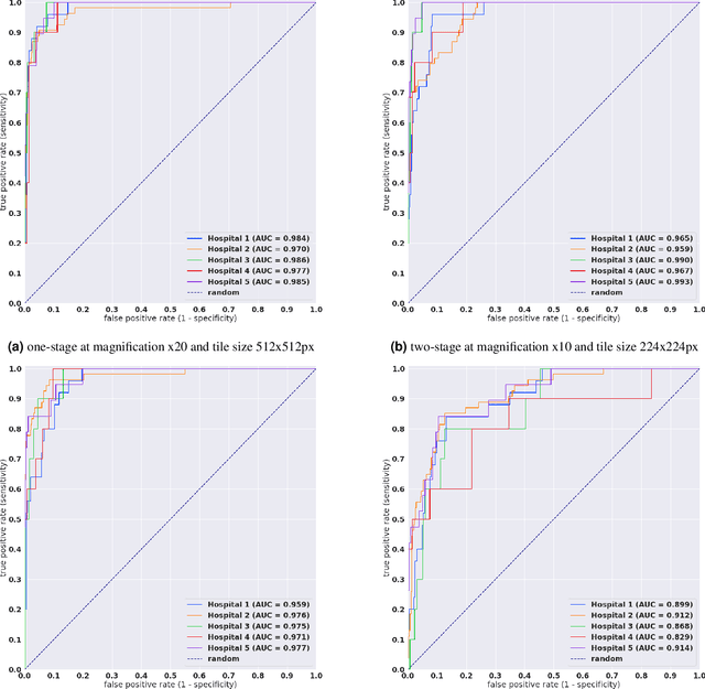 Figure 4 for A deep learning model for gastric diffuse-type adenocarcinoma classification in whole slide images