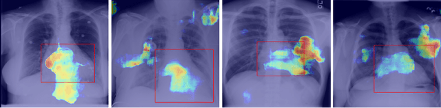 Figure 4 for AutoSeg -- Steering the Inductive Biases for Automatic Pathology Segmentation