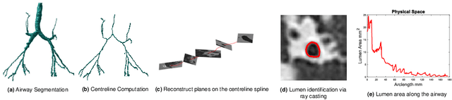 Figure 1 for Modelling Airway Geometry as Stock Market Data using Bayesian Changepoint Detection