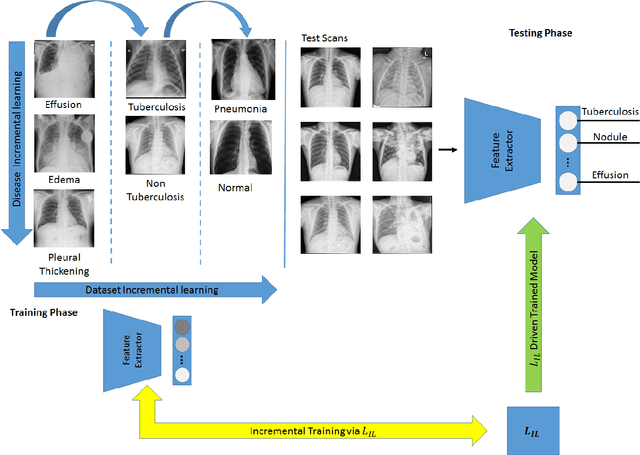 Figure 3 for An Incremental Learning Approach to Automatically Recognize Pulmonary Diseases from the Multi-vendor Chest Radiographs