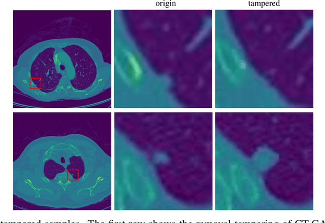 Figure 3 for GAN-based Medical Image Small Region Forgery Detection via a Two-Stage Cascade Framework