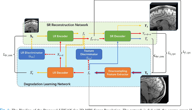 Figure 1 for Unsupervised Representation Learning for 3D MRI Super Resolution with Degradation Adaptation