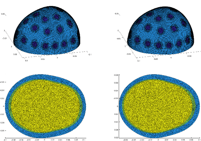 Figure 1 for Neural networks for classification of strokes in electrical impedance tomography on a 3D head model