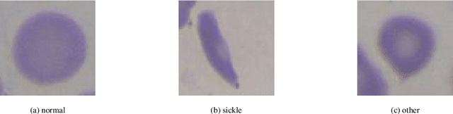 Figure 1 for Sickle-cell disease diagnosis support selecting the most appropriate machinelearning method: Towards a general and interpretable approach for cellmorphology analysis from microscopy images