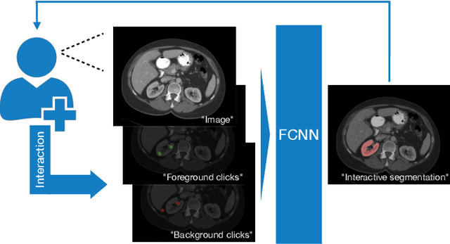 Figure 1 for Interactive segmentation of medical images through fully convolutional neural networks