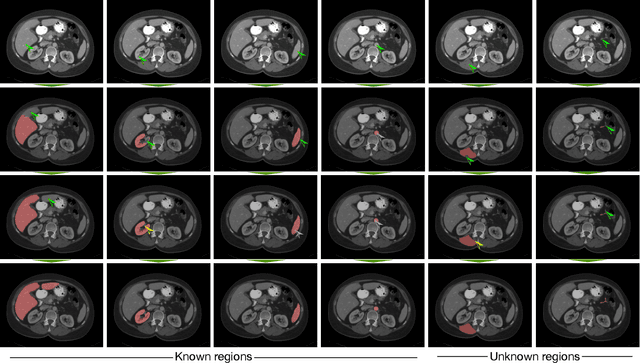 Figure 3 for Interactive segmentation of medical images through fully convolutional neural networks