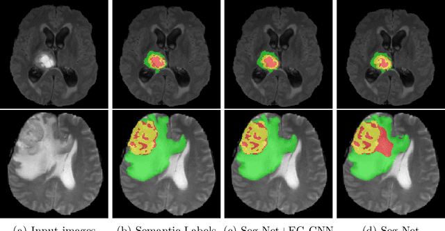 Figure 3 for Edge-Gated CNNs for Volumetric Semantic Segmentation of Medical Images