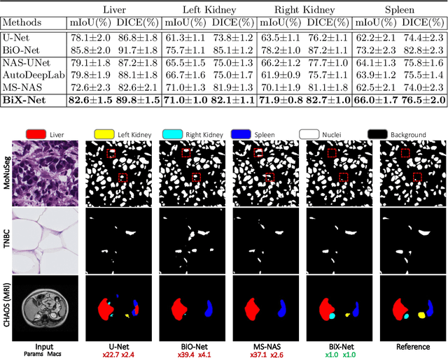 Figure 4 for BiX-NAS: Searching Efficient Bi-directional Architecture for Medical Image Segmentation