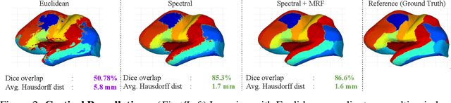 Figure 2 for Graph Convolutions on Spectral Embeddings: Learning of Cortical Surface Data