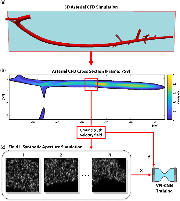Figure 2 for Demonstration of Vector Flow Imaging using Convolutional Neural Networks