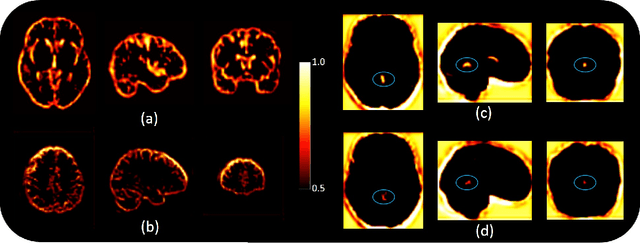 Figure 2 for MRI to PET Cross-Modality Translation using Globally and Locally Aware GAN for Multi-Modal Diagnosis of Alzheimer's Disease