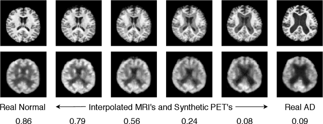 Figure 3 for MRI to PET Cross-Modality Translation using Globally and Locally Aware GAN for Multi-Modal Diagnosis of Alzheimer's Disease
