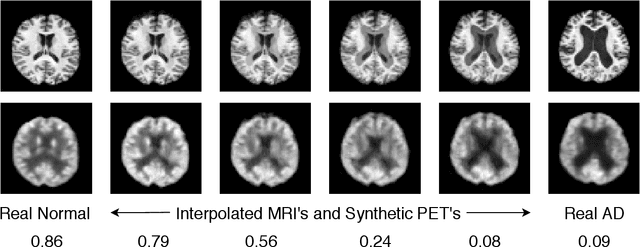 Figure 3 for MRI to PET Cross-Modality Translation using Globally and Locally Aware GAN (GLA-GAN) for Multi-Modal Diagnosis of Alzheimer's Disease