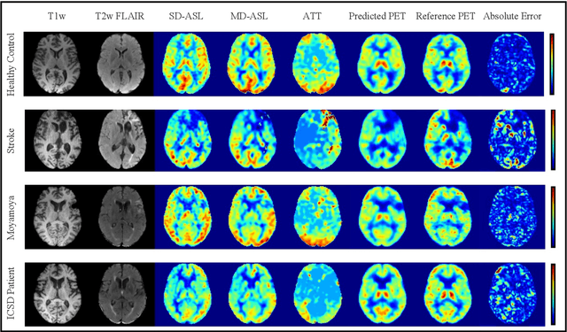 Figure 3 for Multi-task Deep Learning for Cerebrovascular Disease Classification and MRI-to-PET Translation