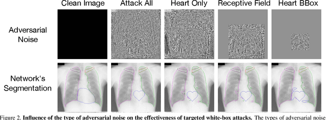 Figure 2 for State-of-the-art segmentation network fooled to segment a heart symbol in chest X-Ray images