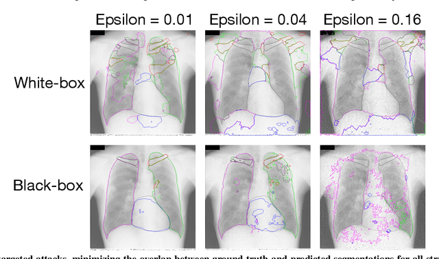 Figure 4 for State-of-the-art segmentation network fooled to segment a heart symbol in chest X-Ray images