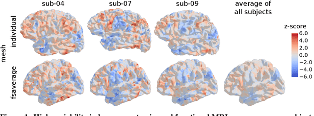 Figure 1 for Aligning individual brains with Fused Unbalanced Gromov-Wasserstein