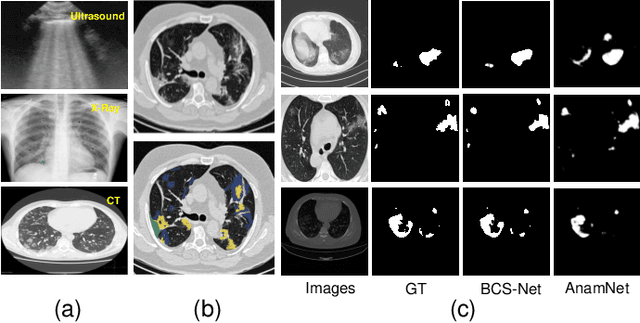 Figure 1 for BCS-Net: Boundary, Context and Semantic for Automatic COVID-19 Lung Infection Segmentation from CT Images