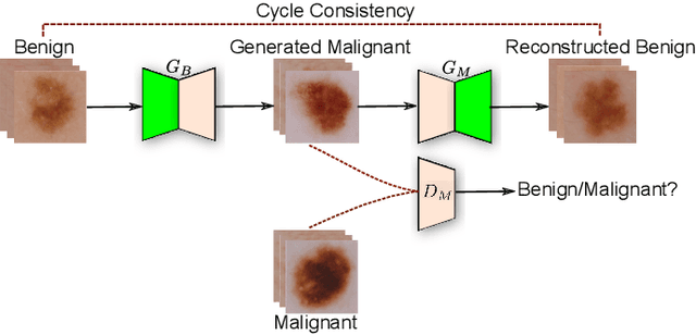 Figure 1 for Melanoma Detection using Adversarial Training and Deep Transfer Learning