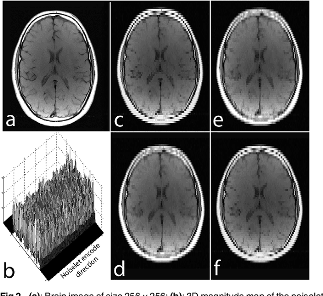 Figure 2 for Multichannel Compressive Sensing MRI Using Noiselet Encoding