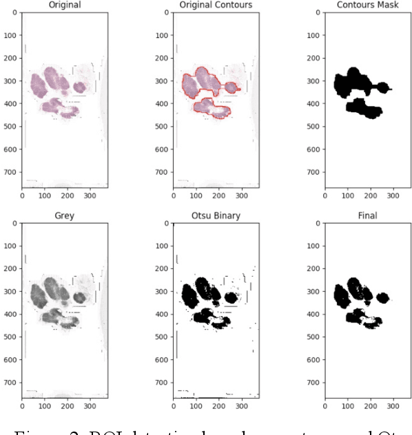 Figure 2 for Detection and Classification of Breast Cancer Metastates Based on U-Net