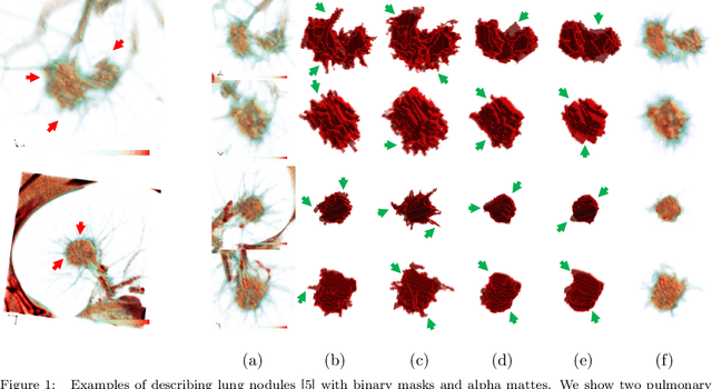 Figure 1 for 3D Matting: A Benchmark Study on Soft Segmentation Method for Pulmonary Nodules Applied in Computed Tomography
