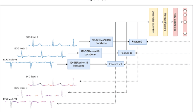 Figure 3 for LightX3ECG: A Lightweight and eXplainable Deep Learning System for 3-lead Electrocardiogram Classification