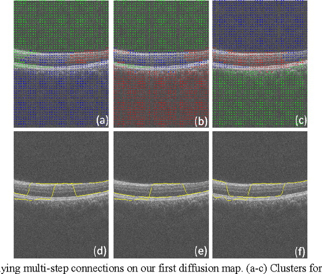 Figure 1 for Intra-Retinal Layer Segmentation of 3D Optical Coherence Tomography Using Coarse Grained Diffusion Map