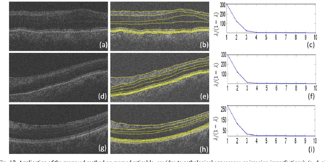 Figure 2 for Intra-Retinal Layer Segmentation of 3D Optical Coherence Tomography Using Coarse Grained Diffusion Map