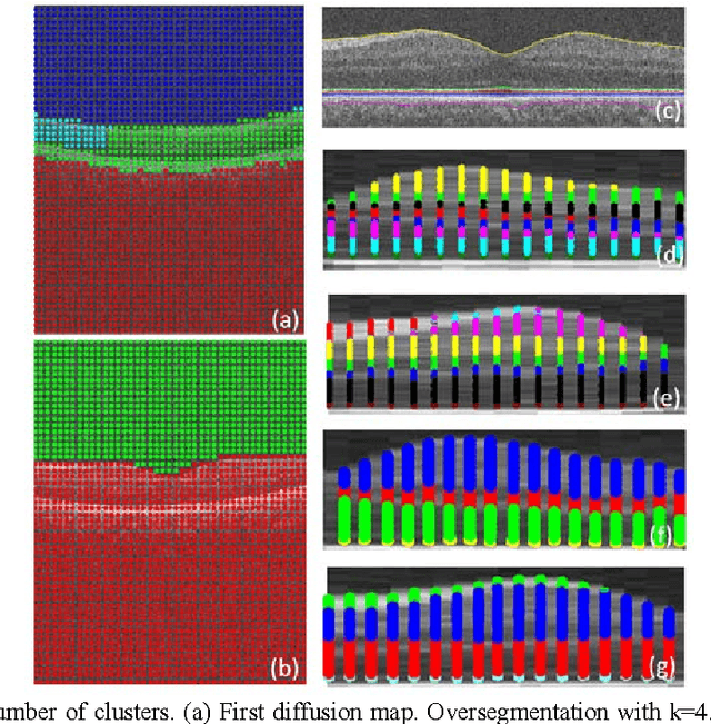 Figure 3 for Intra-Retinal Layer Segmentation of 3D Optical Coherence Tomography Using Coarse Grained Diffusion Map
