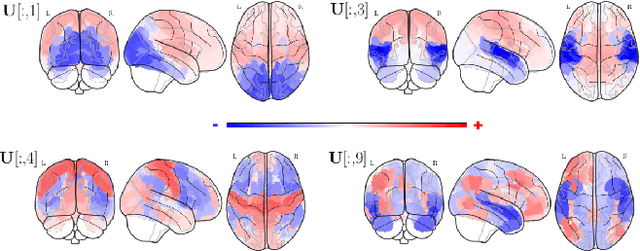 Figure 4 for Pruning Graph Convolutional Networks to select meaningful graph frequencies for fMRI decoding