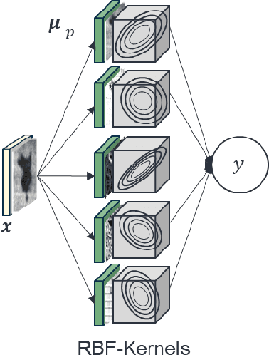 Figure 2 for Siamese Basis Function Networks for Defect Classification