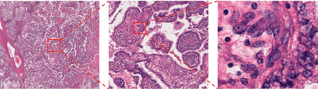 Figure 4 for Machine learning methods for histopathological image analysis