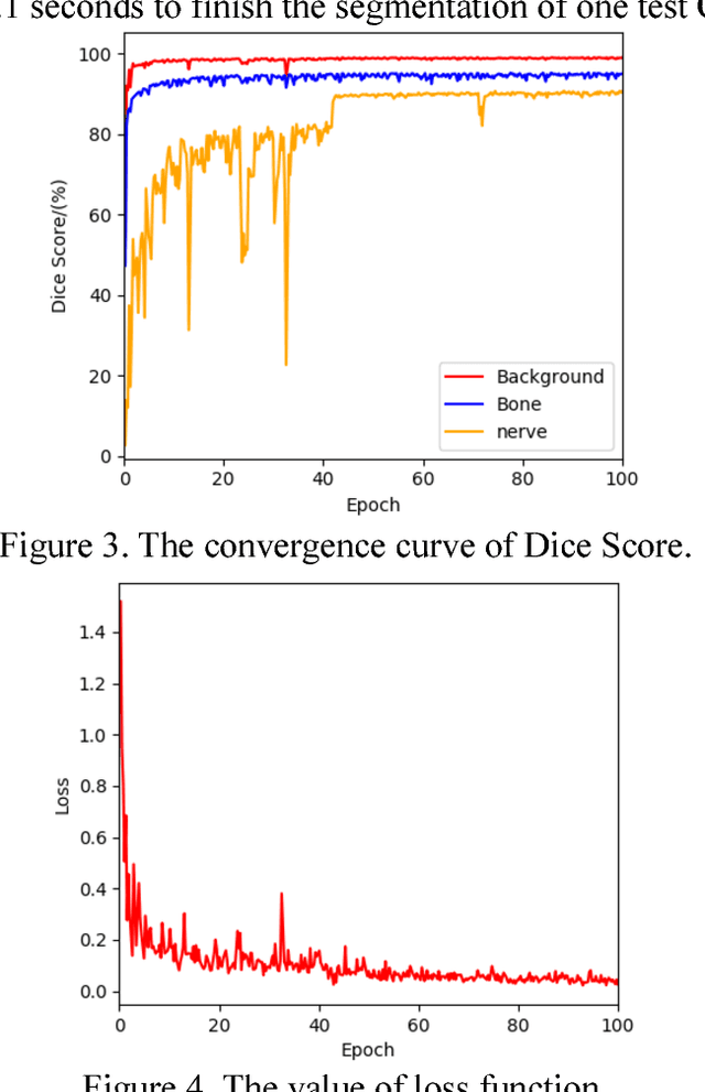 Figure 4 for Deep learning based automatic segmentation of lumbosacral nerves on non-contrast CT for radiographic evaluation: a pilot study