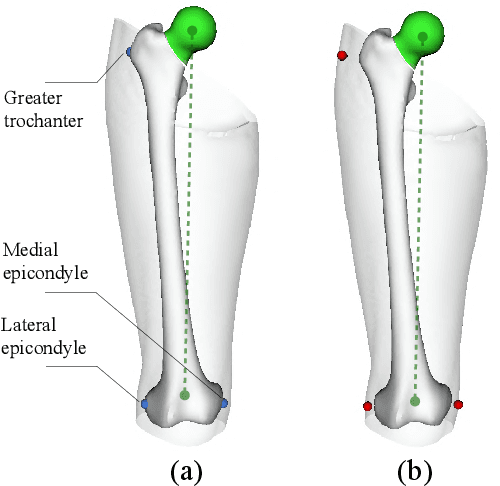 Figure 1 for Bone Surface Reconstruction and Clinical Features Estimation from Sparse Landmarks and Statistical Shape Models: A feasibility study on the femur