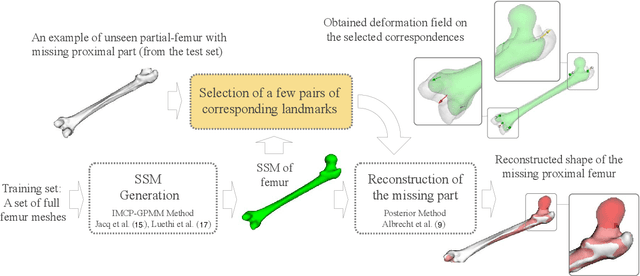 Figure 4 for Bone Surface Reconstruction and Clinical Features Estimation from Sparse Landmarks and Statistical Shape Models: A feasibility study on the femur