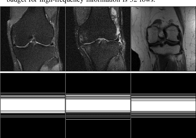 Figure 3 for Single-pass Object-adaptive Data Undersampling and Reconstruction for MRI