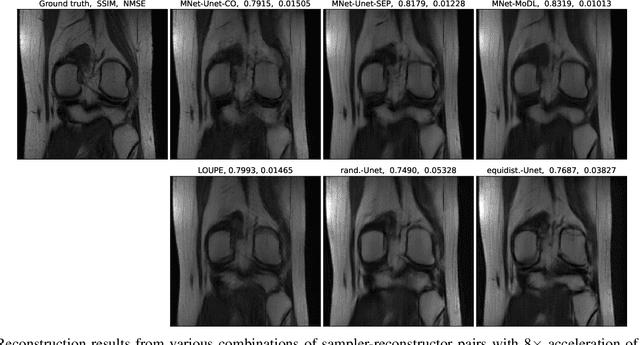 Figure 4 for Single-pass Object-adaptive Data Undersampling and Reconstruction for MRI