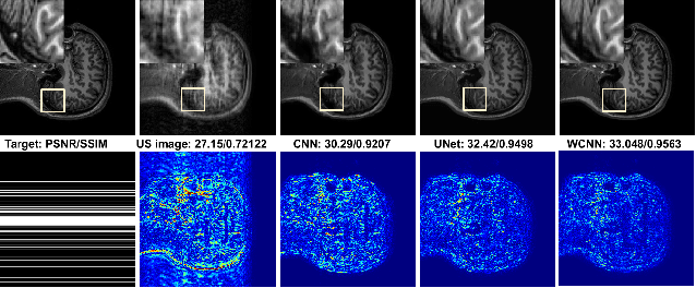 Figure 4 for DC-WCNN: A deep cascade of wavelet based convolutional neural networks for MR Image Reconstruction