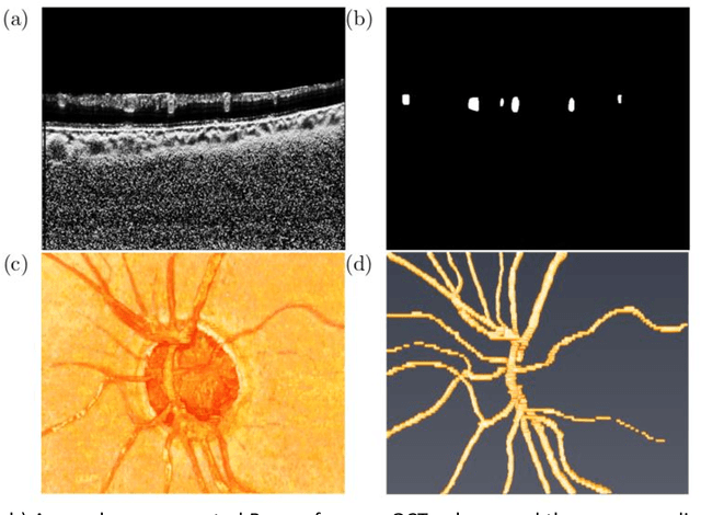 Figure 2 for The Three-Dimensional Structural Configuration of the Central Retinal Vessel Trunk and Branches as a Glaucoma Biomarker