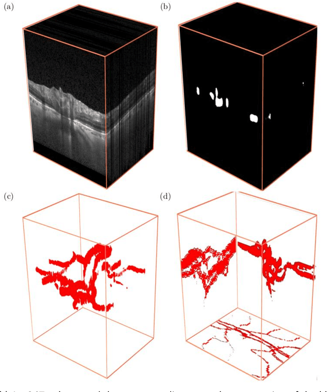 Figure 3 for The Three-Dimensional Structural Configuration of the Central Retinal Vessel Trunk and Branches as a Glaucoma Biomarker