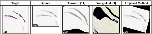 Figure 3 for Automatic Multi-Stain Registration of Whole Slide Images in Histopathology