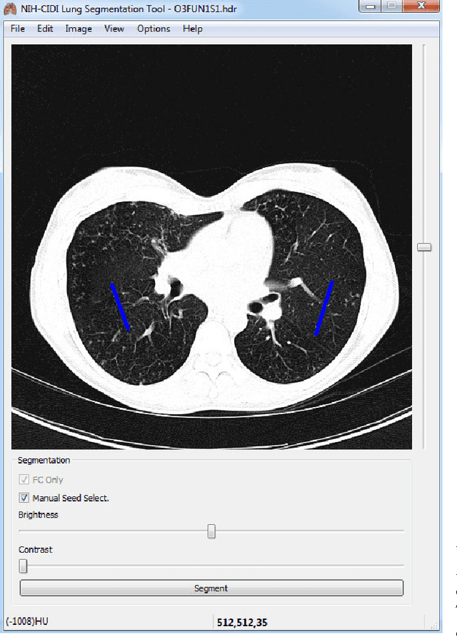 Figure 1 for CIDI-Lung-Seg: A Single-Click Annotation Tool for Automatic Delineation of Lungs from CT Scans