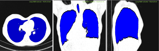 Figure 3 for CIDI-Lung-Seg: A Single-Click Annotation Tool for Automatic Delineation of Lungs from CT Scans
